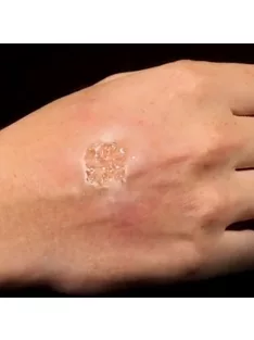 Grimas Blister Gel smink, hólyagok szimulálására